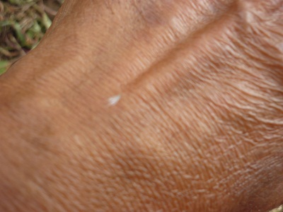 tiny fungal insect tiny fungal insect
